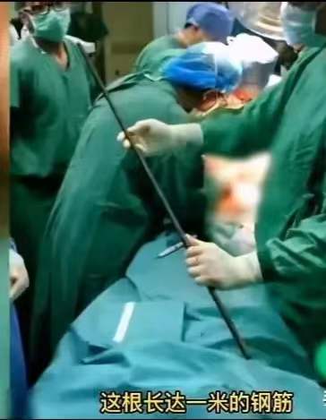 露营时一男子竟被钢筋刺穿，后续如何