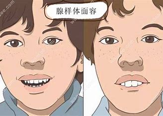女艺人公开儿子照片，这病冲上热搜